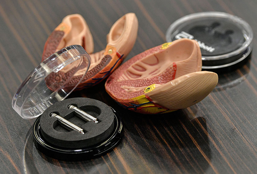 Implan perentak jantung dwi-ruang tanpa wayar pertama di Asia Tenggara yang ditunjukkan pada sidang media di Institut Jantung Negara (IJN) hari ini. - Foto Bernama